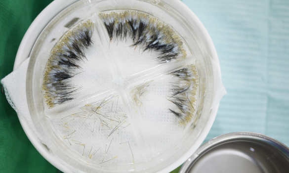 臓器移植手術と同じ手術環境