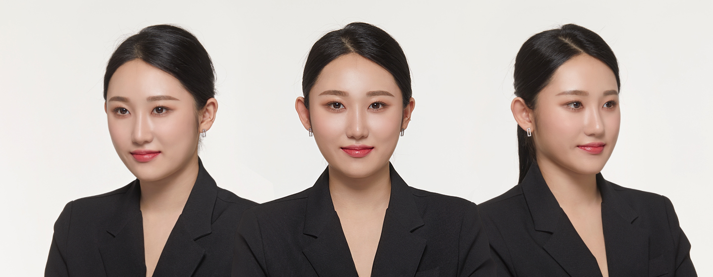 バランスの取れた小顔を作る額縮小ヘアーライン矯正