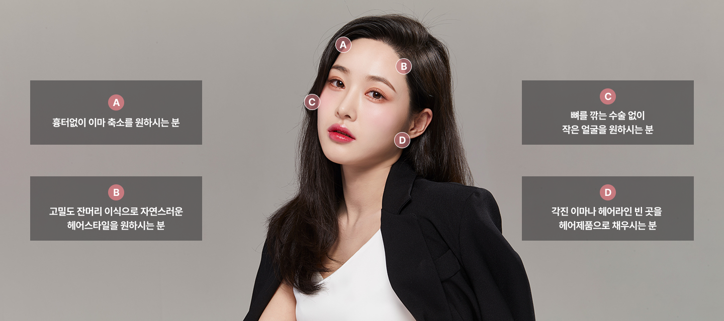 ヘアーライン矯正の効果がよく現れたケース