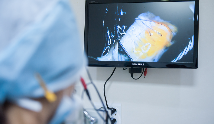 高倍率デジタル顕微鏡分離