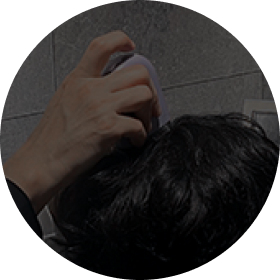 treatment-examination.一人ひとりに合った脱毛症治療法提供