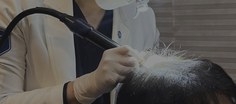 頭皮のタトゥー